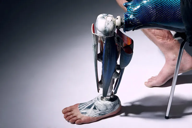 Konami Commissioning Metal Gear Solid V Prosthetic For An Amputee Gamer